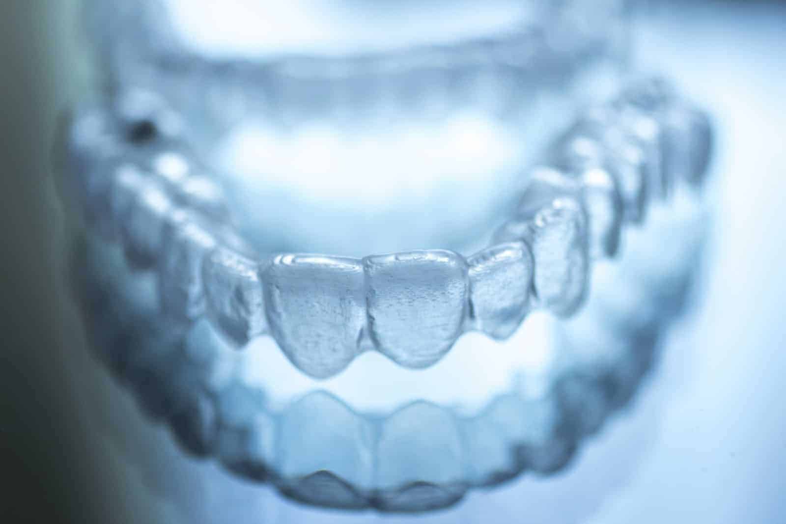 invisalign in kissimmee