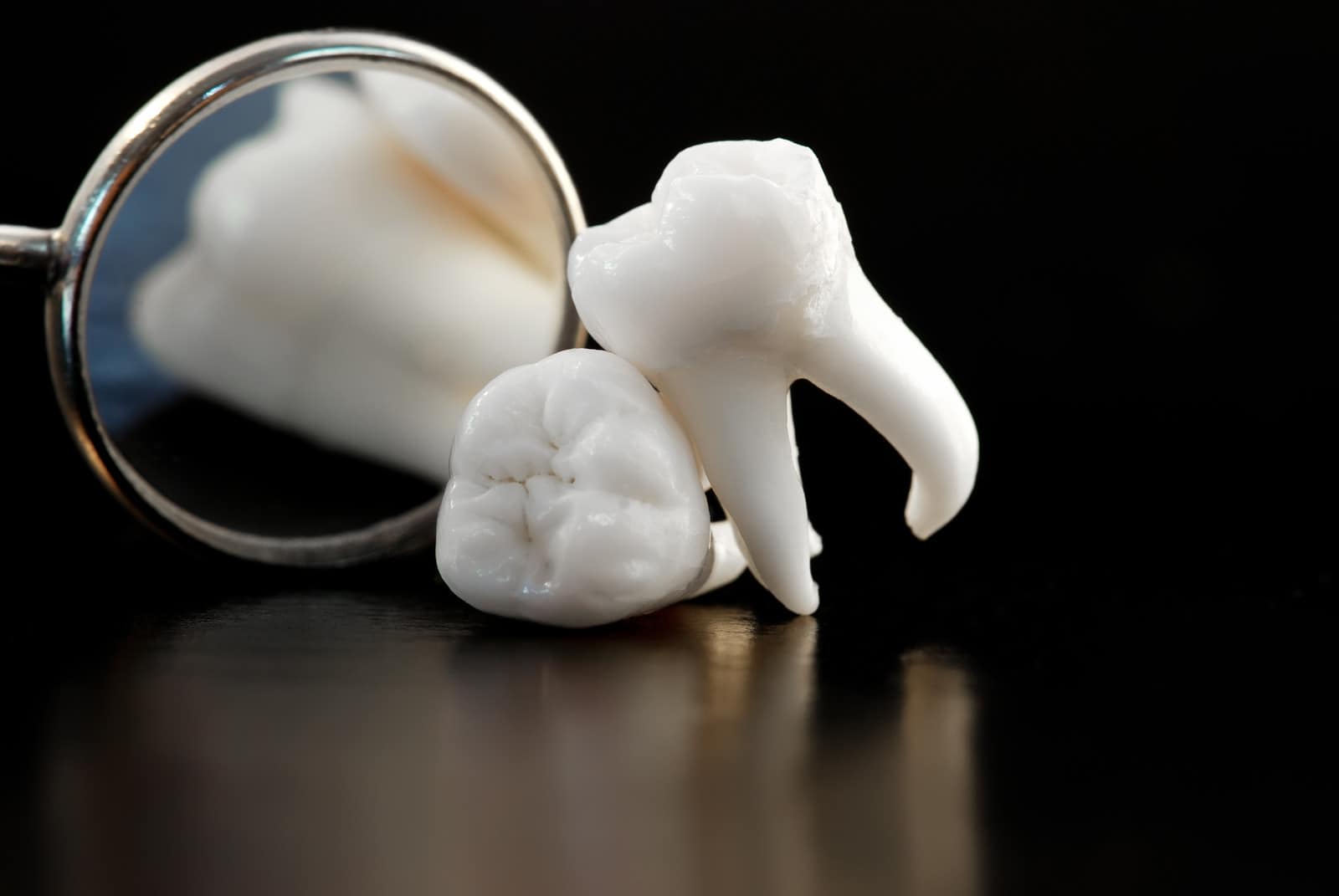wisdom teeth extractions in kissimmee
