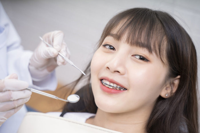 get straighter teeth in orthodontics