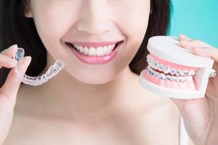 need to know about invisalign treatment