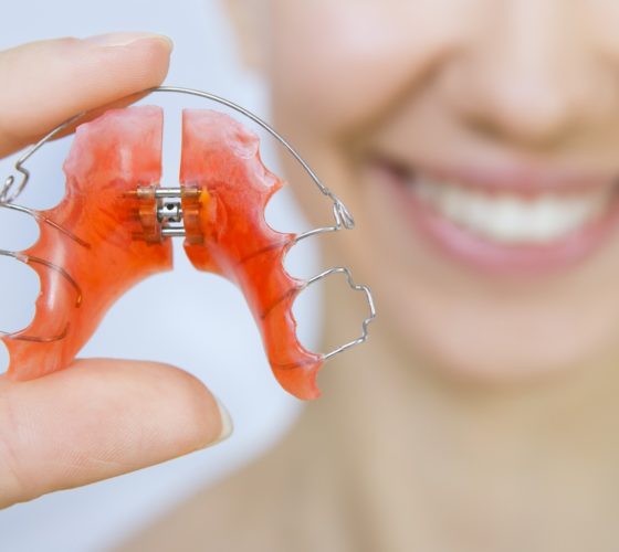 Retainers in Kissimmee