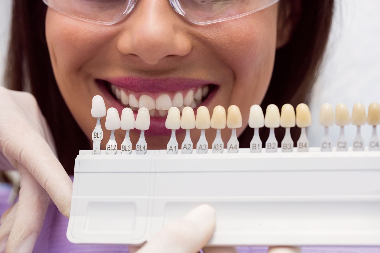 What Are Porcelain Veneers and How Do They Improve Your Smile?