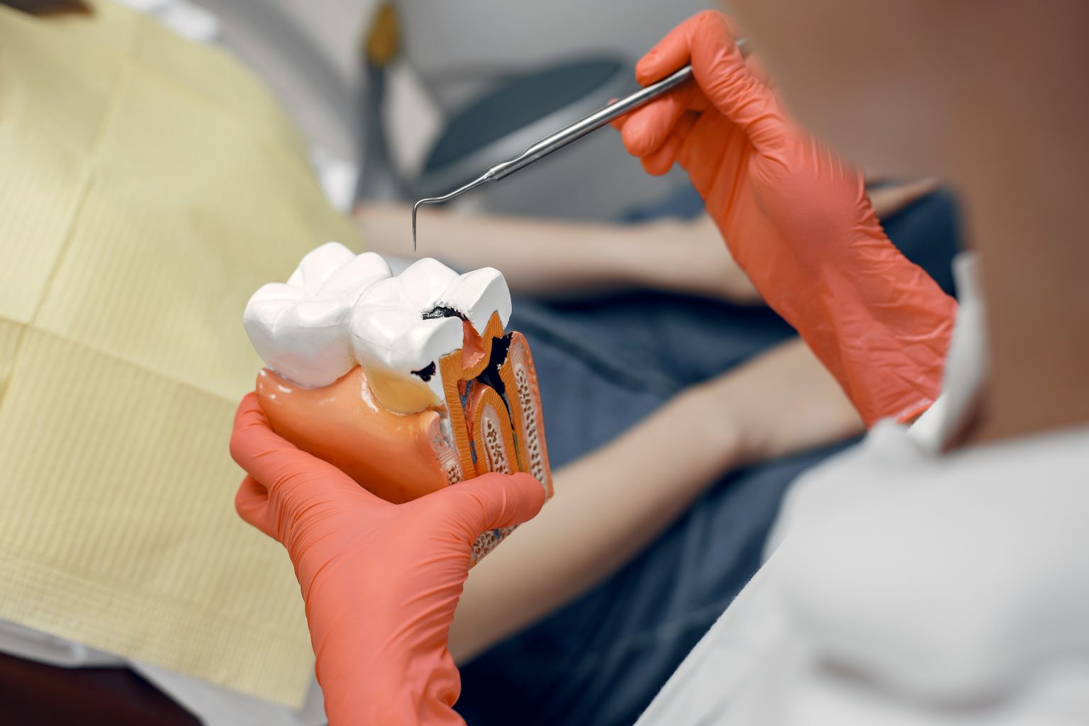 How Dental Sealants Help Prevent Cavities