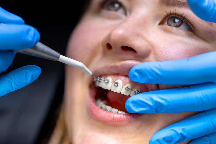Signs you need an orthodontist for teeth alignment problems